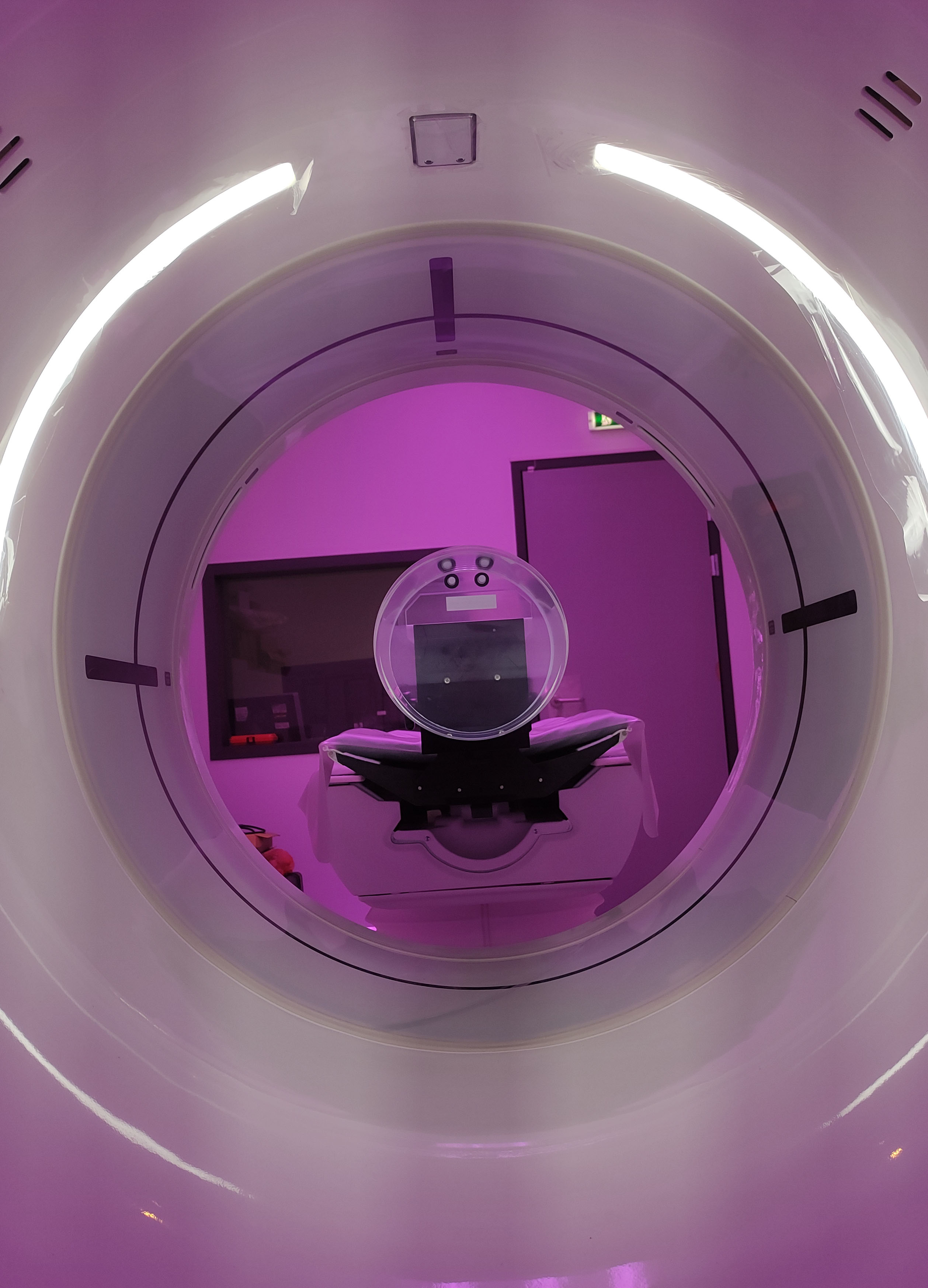 CT Scan Revolution